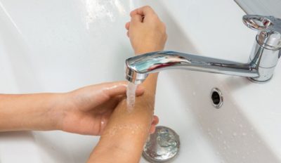 Una persona se moja el brazo con agua fría. ShutterStock